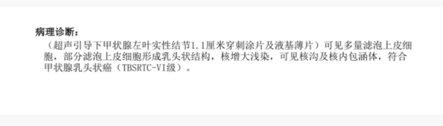 甲状腺穿刺细胞学报告,提示符合甲状腺乳头状癌 TBSRTC-VI 级